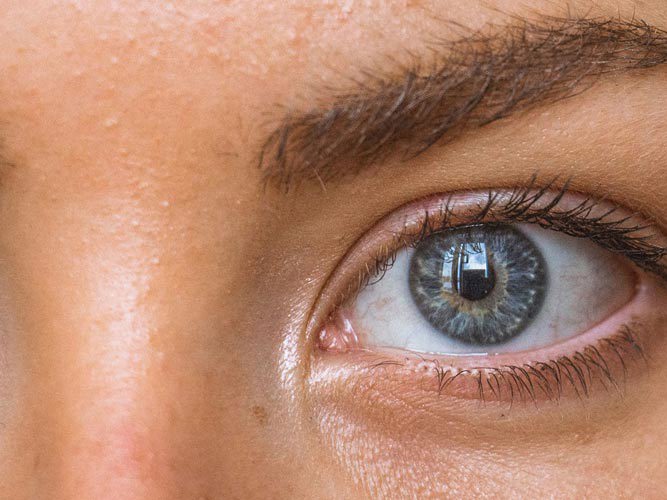 nærbilde ung kvinne med uren hud.