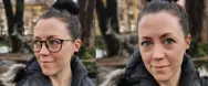 Pasient Hannah med og uten briller, før og etter laseroperasjon på Aleris.