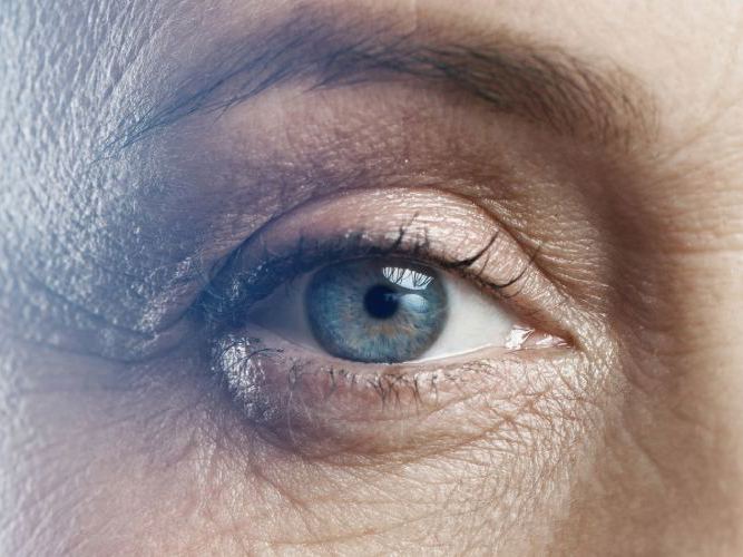 Nærbilde av et øye hos optiker | Aleris