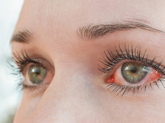 Nærbilde røde øyne