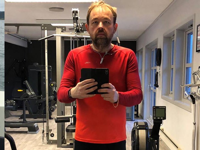 Lasse Jacobsen slankeoperasjon før og etter.